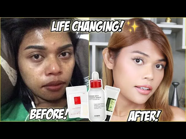 helloooo mga cuuurls! so this is an easy skincare and makeup routine for oily and acne prone skin na nakakashikep!
PRODUCT MENTIONED:
COSRX AC Collection Blemish Spot Clearing Serum
COSRX Acne Pimple Master Patch
COSRX AloeSoothing Sun CreamSPF50+ PA+++
✅SHOP IN COSRX HERE!
https://bit.ly/3CmfG6U
https://bit.ly/3CmfG6U
https://bit.ly/3CmfG6U
✅USE CODE "COSRX1212"
✅AC Serum 1+1 (Limited Stock)
✅12.12 Storewide Up to 50% OFF
✅AC Collection Line Up to 50% OFF
*** DONT FORGET TO LIKE COMMENT AND SUBSCRIBE***
***Business Inquiries: johnreyslife@gmail.com***
FOLLOW ME:
***INSTAGRAM: https://www.instagram.com/johnreyslife
***TWITTER: https://www.twitter.com/johnreyslife
***FACEBOOK ACCOUNT: https://www.facebook.com/iamjohnrey20
***FACEBOOK PAGE: https://www.facebook.com/johnreyslife
***SNAPCHAT: johnreyslife
**FOLLOW MY DECLUTTERING GIVEAWAY PAGE! FOR FREE MAKEUP!!!!**
https://www.instagram.com/declutteringcurl
https://www.instagram.com/declutteringcurl
https://www.instagram.com/declutteringcurl
Music: http://www.purple-planet.com