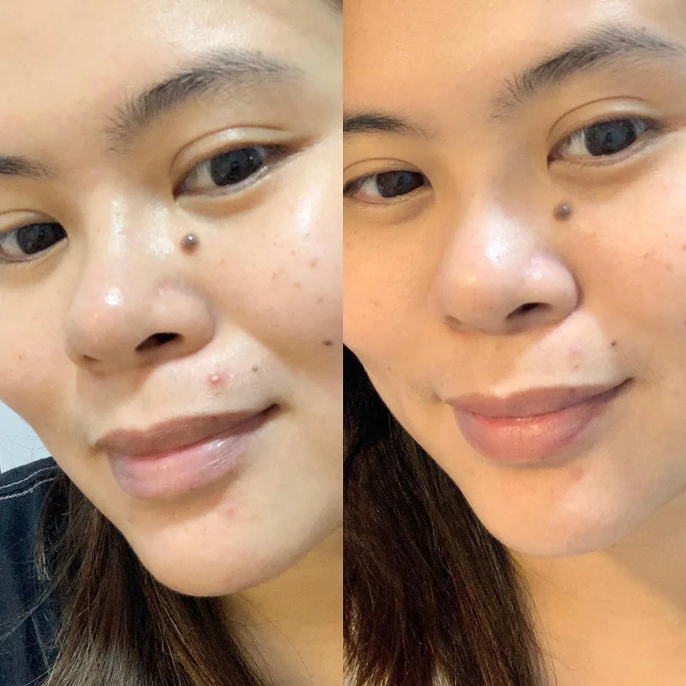 Who wants an overnight solution to their pimples? 🥰🙋🏻♀️
Thanks to Sucral Overnight Solution Cream. This is the answer to an instant recovery for your skin breakouts! 🥰
It helps pimples to dry out overnight. I love to use this Sucral Overnight Solution Cream every start of my breakout! It is super lightweight and is 10x more effective! And ofcourse Derma Tested✔️
It also recovers, calms and protects the skin from harmful stimulis! You can achieve scar-free skin with this Sucral Cream. Definitely #MommyApproved✔️
You can buy this at a discount:
https://shopee.ph/fromchiyou
________________________
#CICAUgraded #SOSCream #ScarEraser #pigmentationcream #confidentwithchiyou #CHIYOUSKIN #charisceleb @chiyouskin